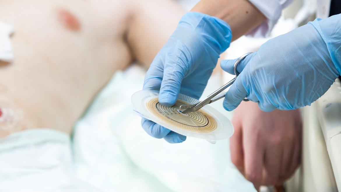 El Instituto de Investigación del Hospital 12 de Octubre recibe 10.000 euros para promover acciones que mejoren la calidad de vida de los pacientes con ostomía