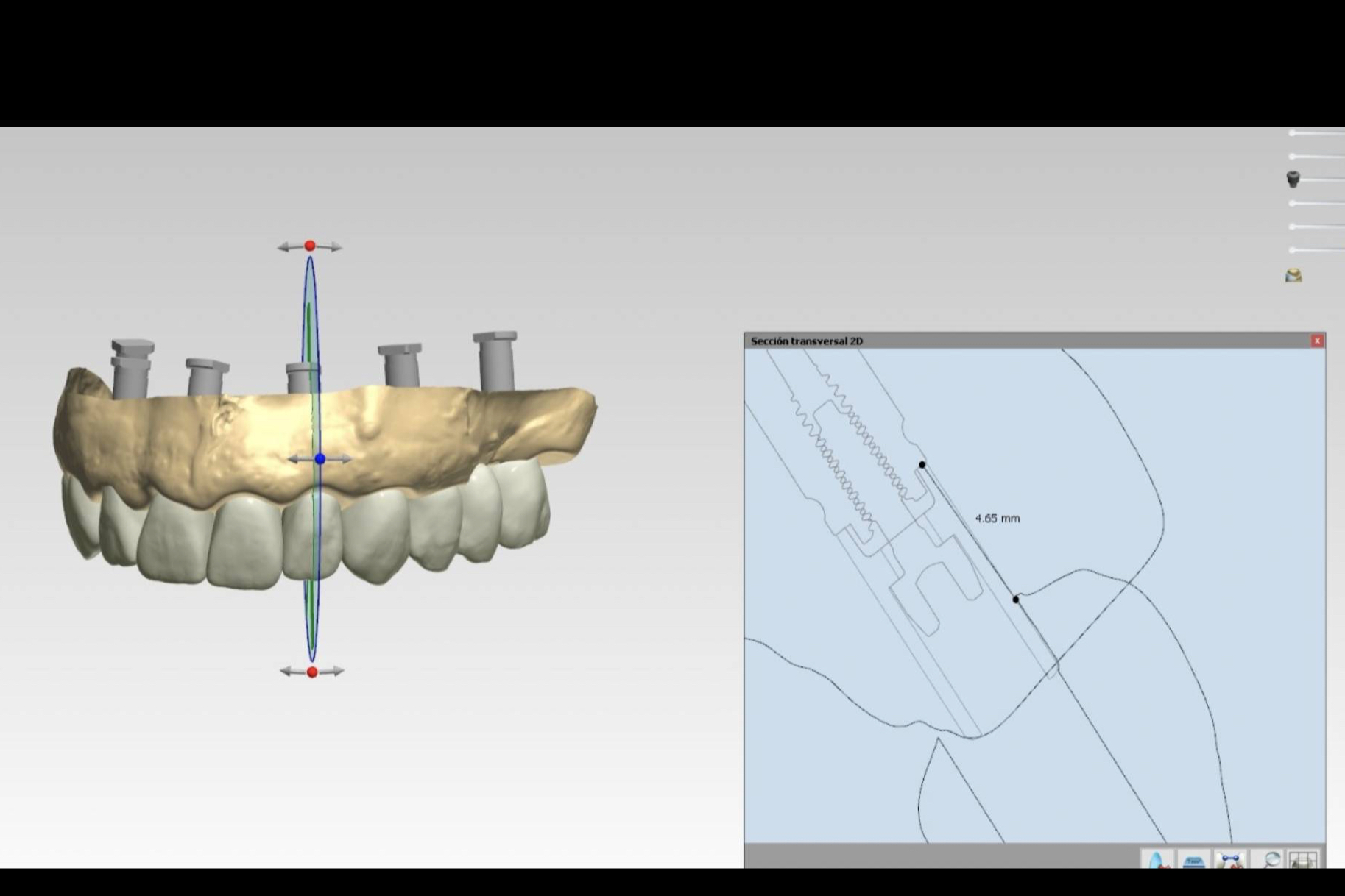 Odontología avanzada en Sabadell; cómo la tecnología redefine la práctica clínica